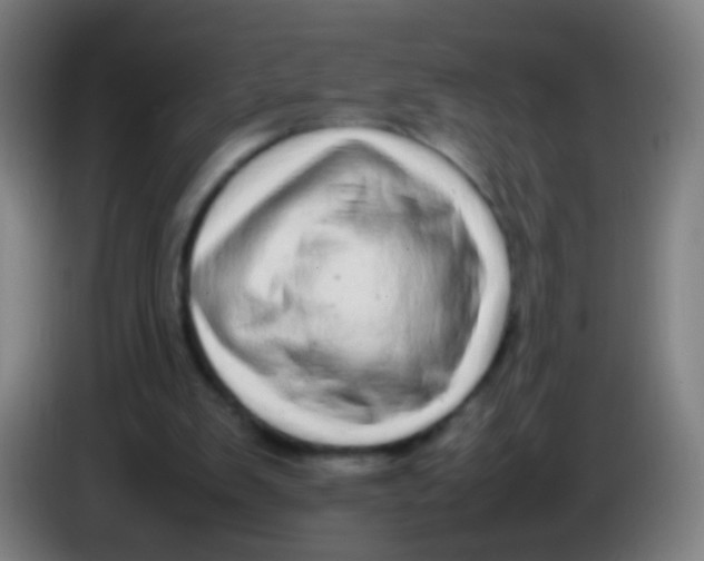 X0000085310103200703302031