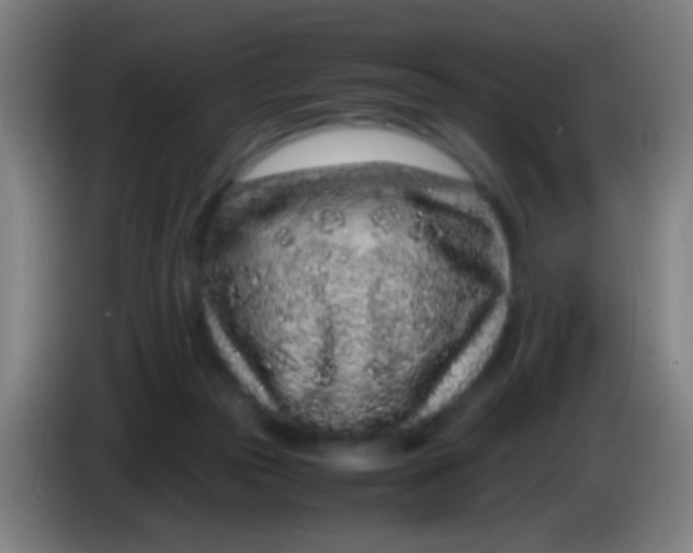 X0000085310169200703302030