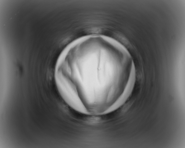 X0000085310374200703302028