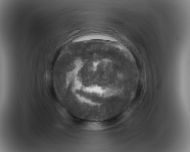 X0000085310409200703302027