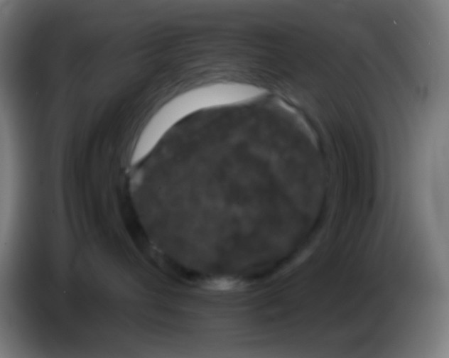 X0000085310432200703302026