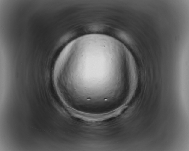 X0000085310447200703302026