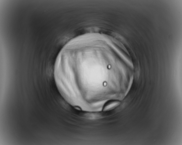 X0000085310477200703302026