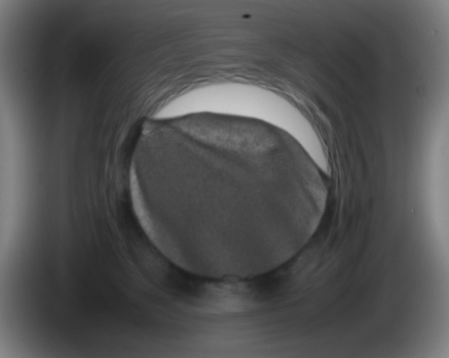 X0000085310517200703302025