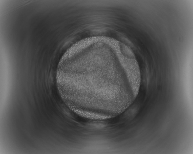 X0000085310758200703302022