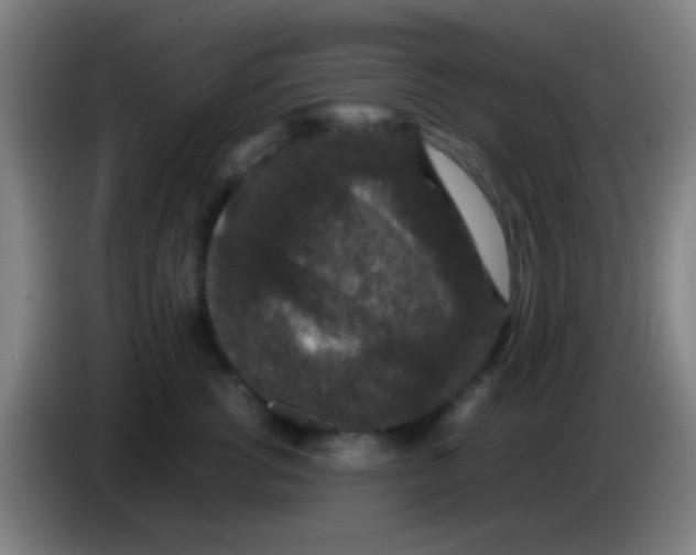 X0000085310762200703302022