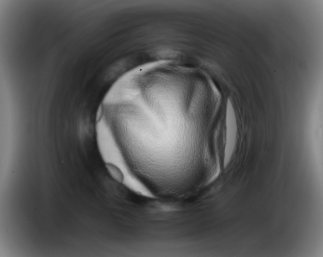 X0000085310763200703302022