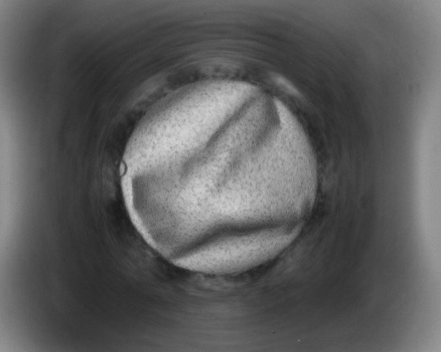 X0000085310774200703302022