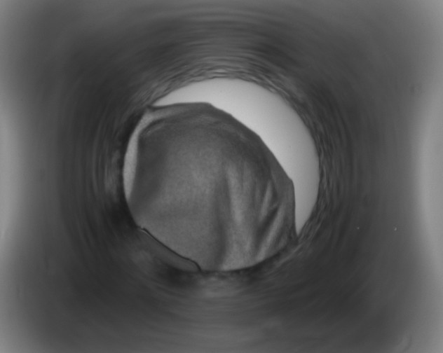 X0000085310868200703302020