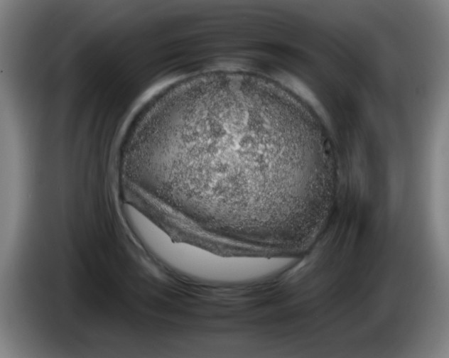 X0000085311035200703302018