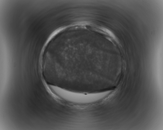 X0000085311046200703302018