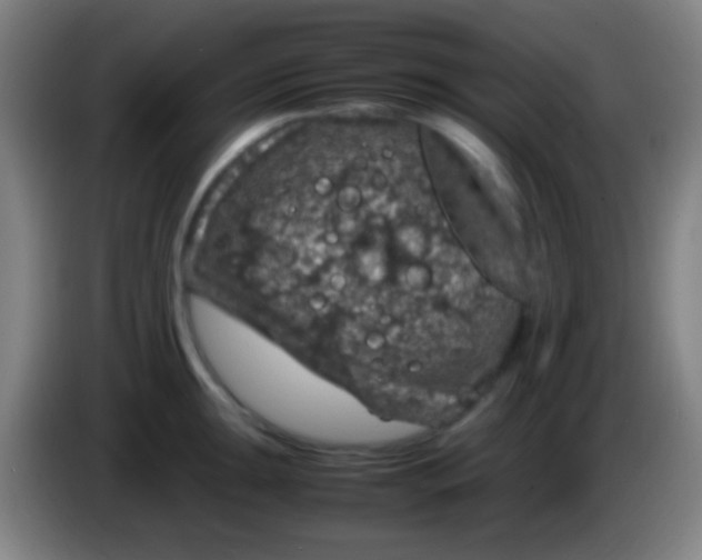 X0000085311047200703302018