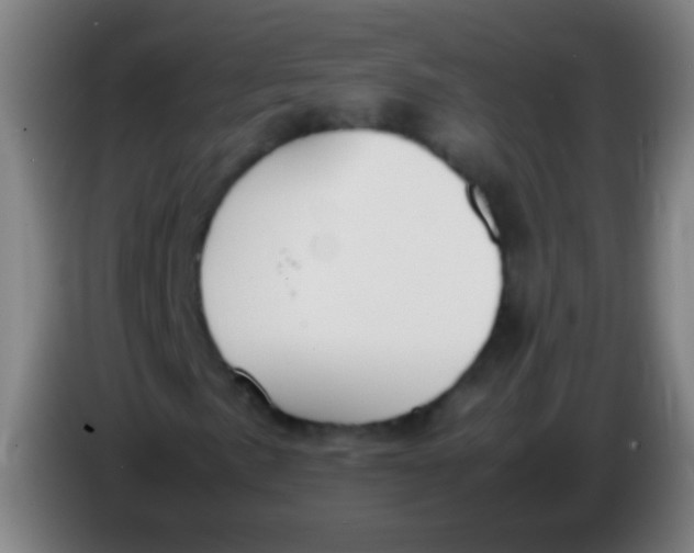 X0000085311057200703302018