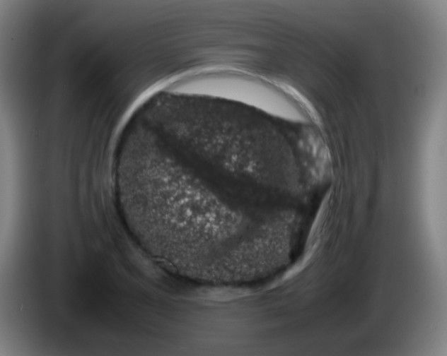 X0000085311077200703302017