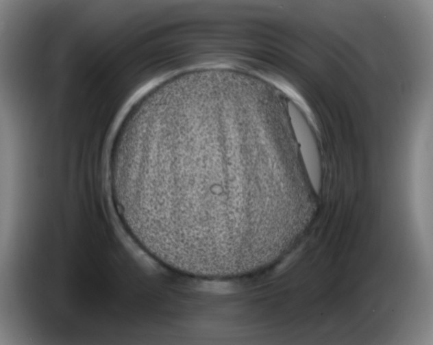 X0000085311088200703302017