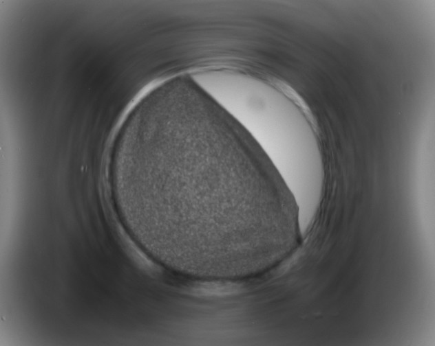 X0000085311091200703302017