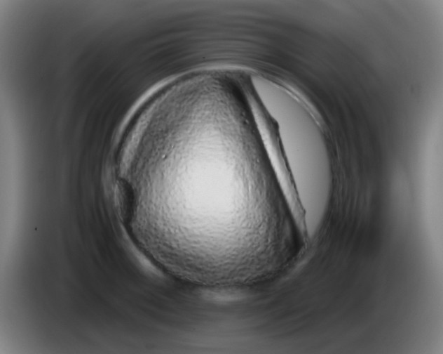 X0000085311092200703302017