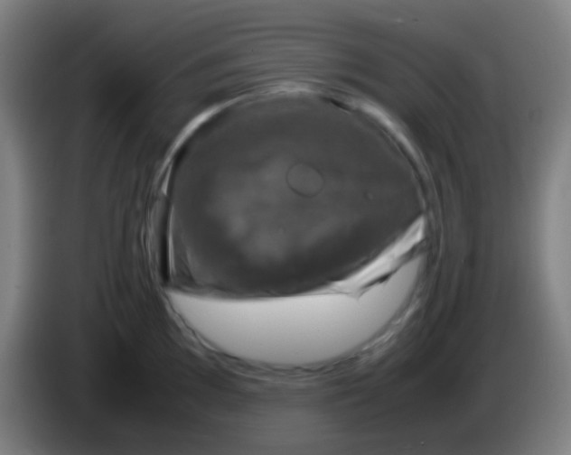 X0000085311097200703302017