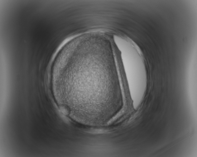 X0000085311099200703302017