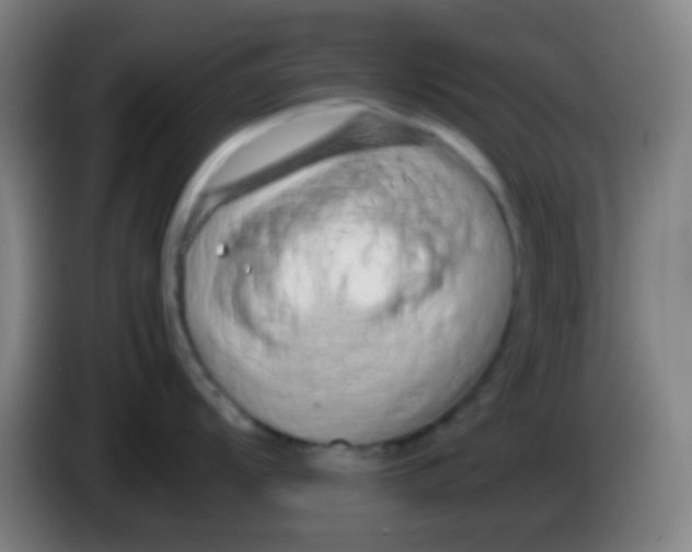 X0000085311104200703302017