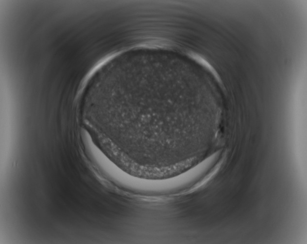 X0000085311114200703302016