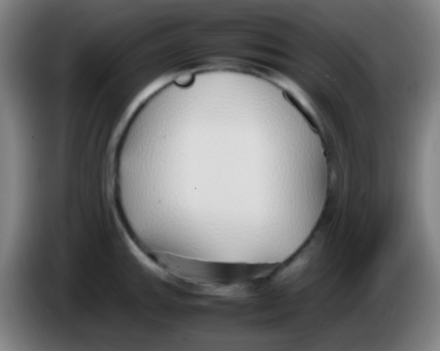 X0000085311143200703302017