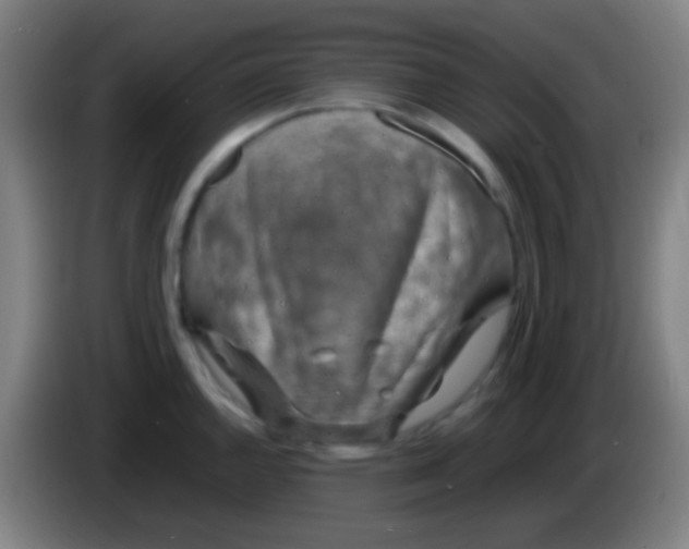 X0000085311144200703302017