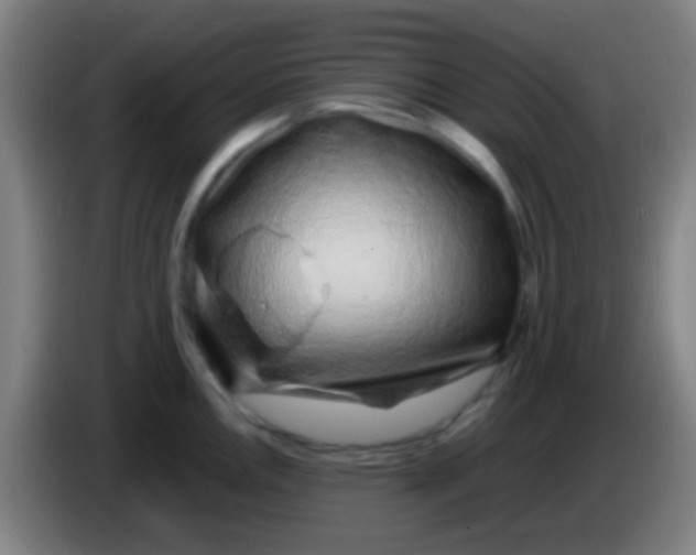 X0000085311146200703302017