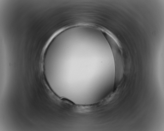 X0000085311148200703302017