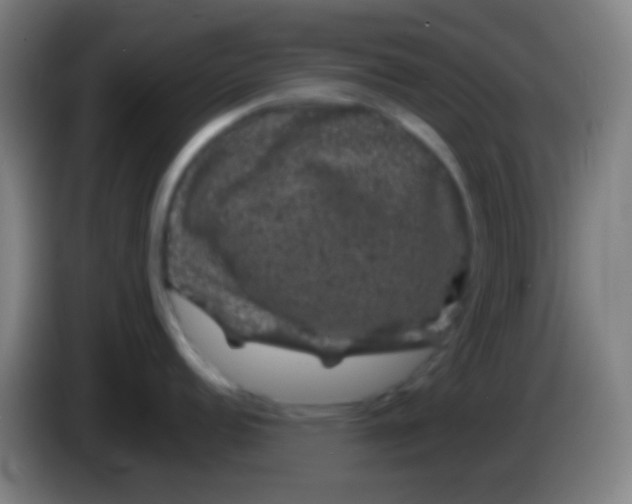 X0000085311152200703302017