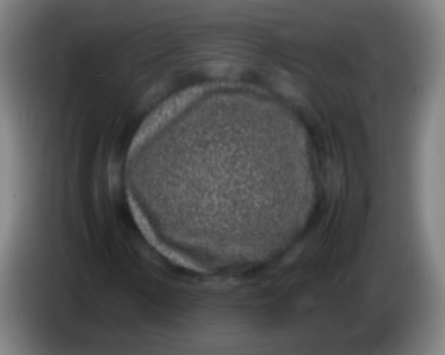 X0000085311154200703302016