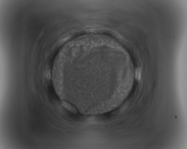 X0000085311155200703302016