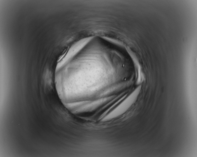 X0000085311156200703302016