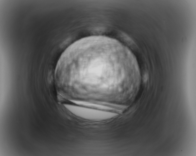 X0000085311204200703302015