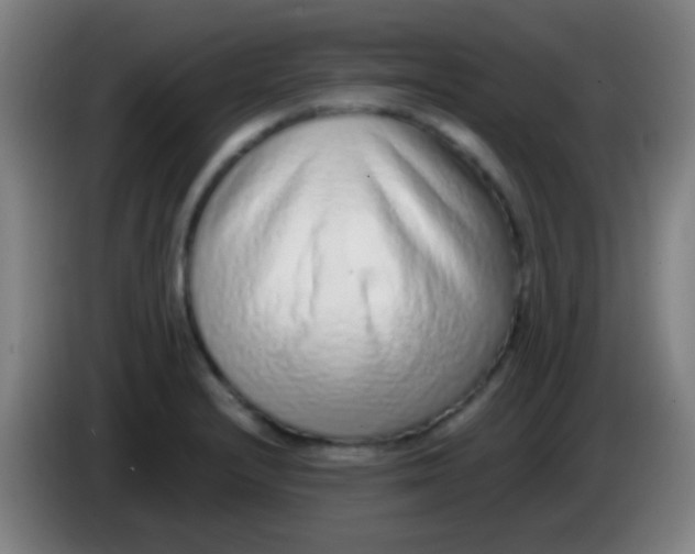 X0000085311232200703302015