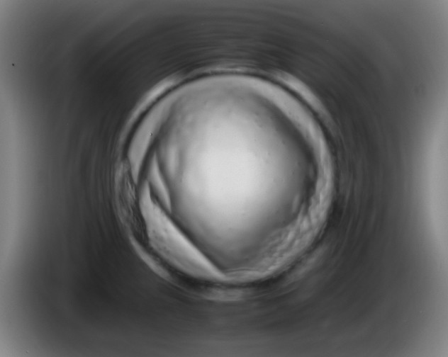 X0000085311237200703302015