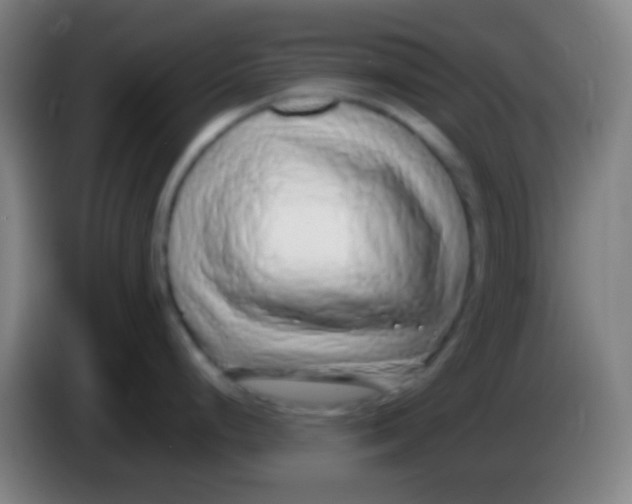 X0000085311248200703302016