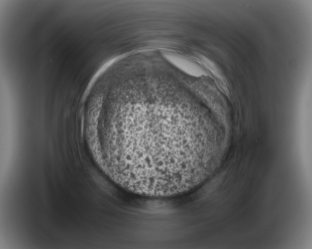 X0000085311275200703302015