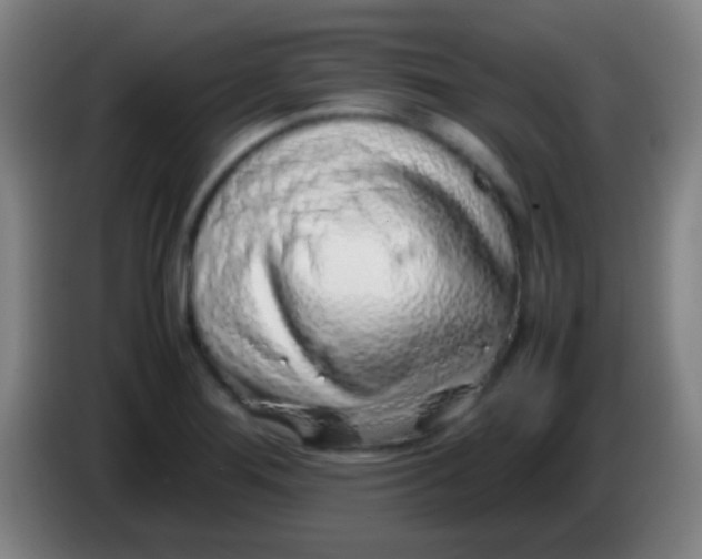 X0000085311276200703302015