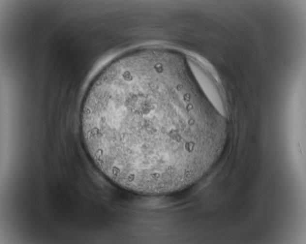 X0000085311279200703302014