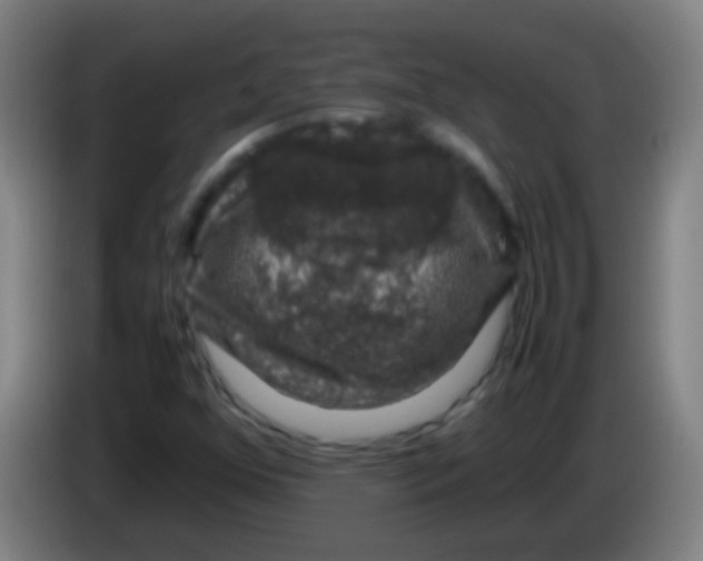 X0000085311352200703302013