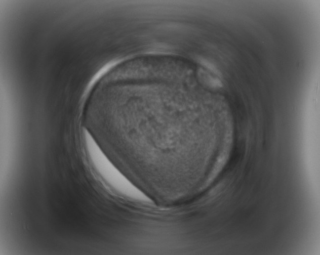 X0000085311463200703302012