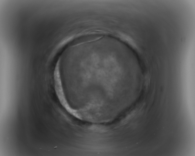 X0000085311496200703302011