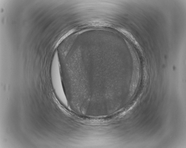 X0000085310889200704092320