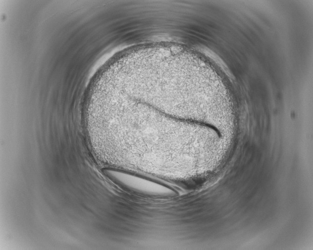 X0000085311023200704092318