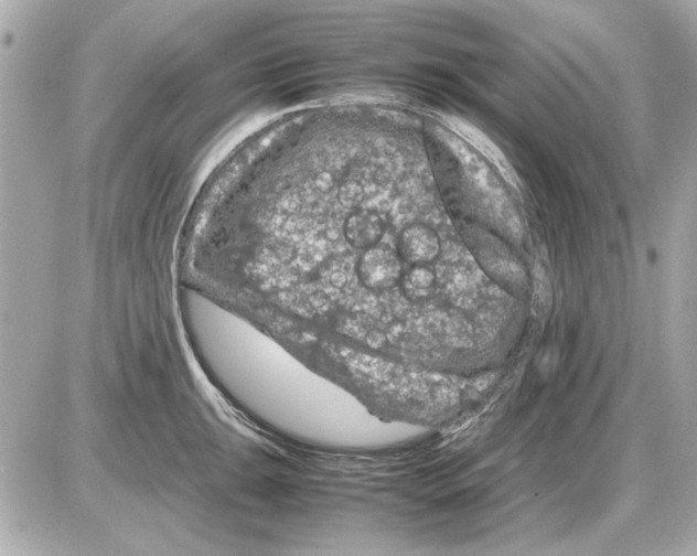 X0000085311047200704092318