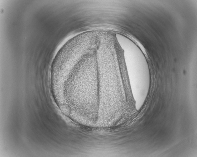 X0000085311099200704092317