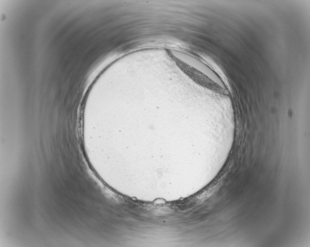 X0000085311103200704092317