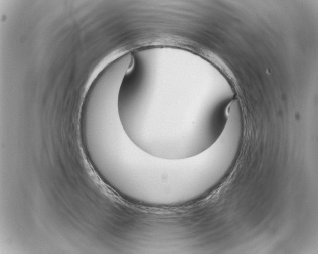 X0000085311138200704092316