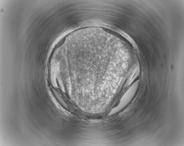 X0000085311144200704092316